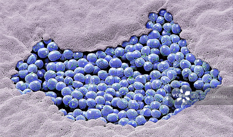 母乳细菌扫描电镜图图片素材