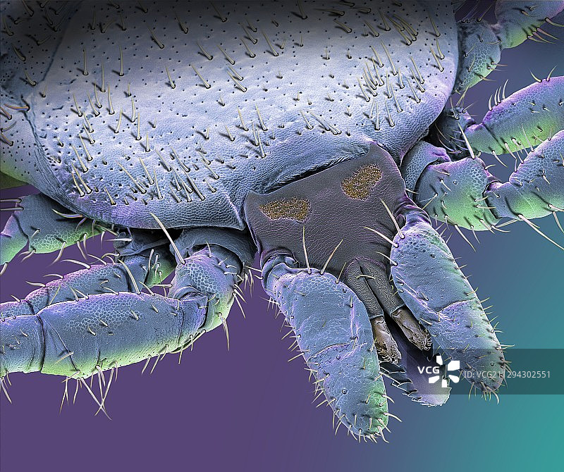 美国犬蜱扫描电镜照片图片素材