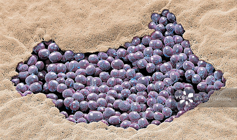 母乳细菌扫描电镜图图片素材