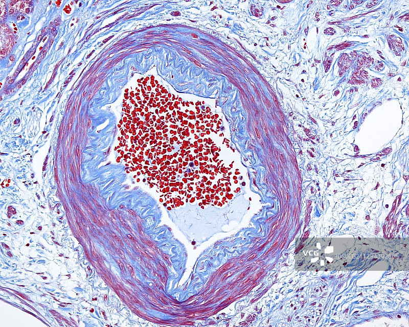 肾小球显微照片图片素材