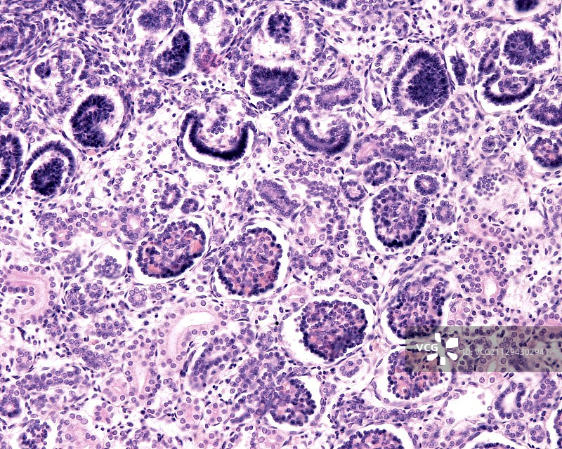 发育中的肾脏，光学显微照片图片素材