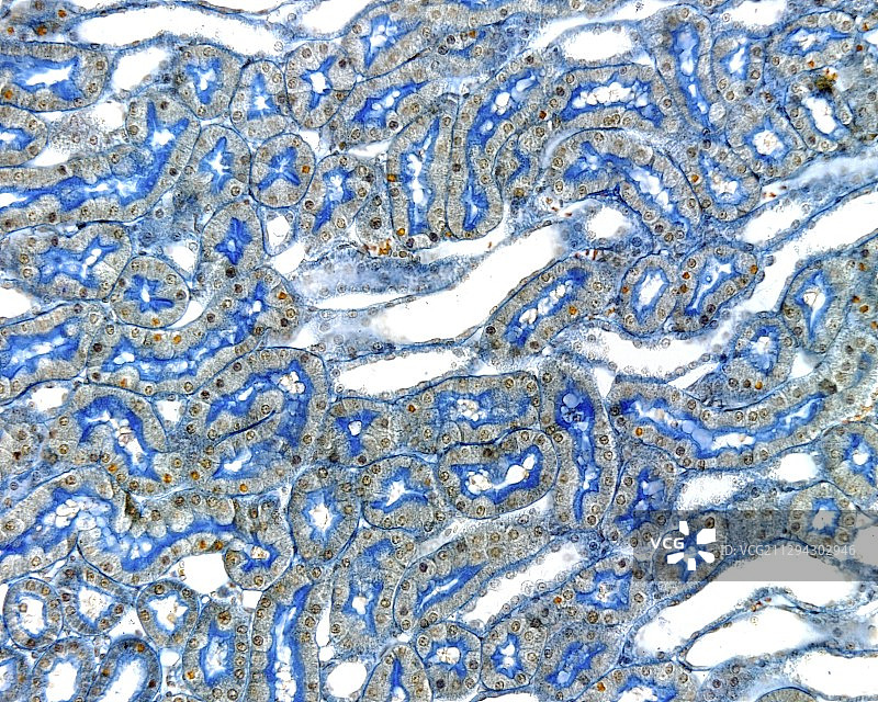 肾脏的肾小管，光学显微照片图片素材