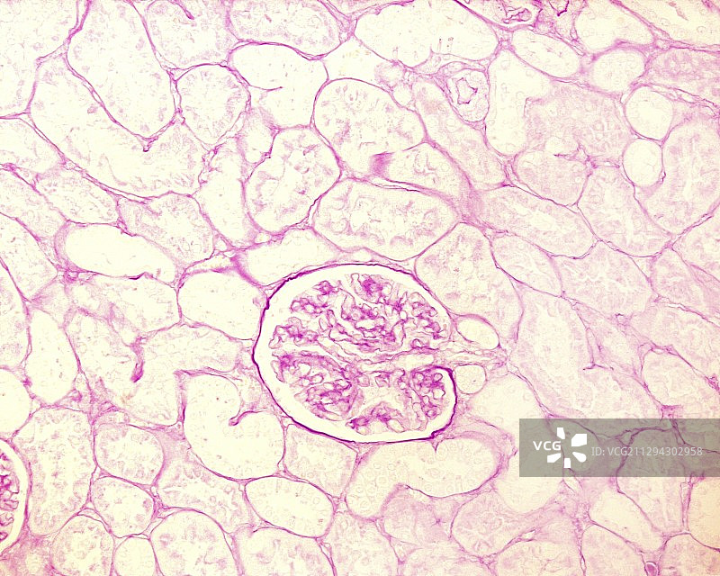 肾脏基底膜显微照片图片素材