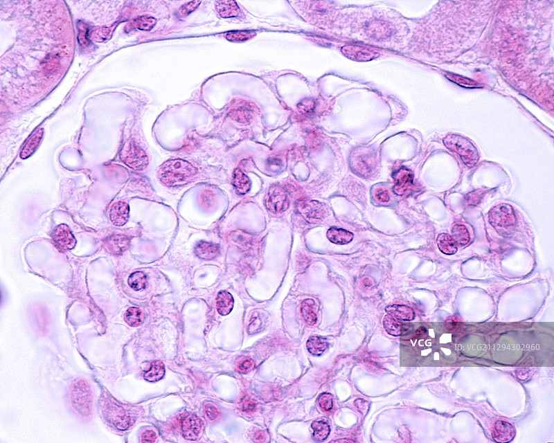肾小球显微照片图片素材