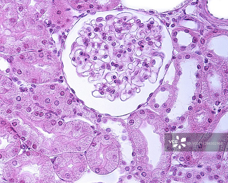 肾小球显微照片图片素材