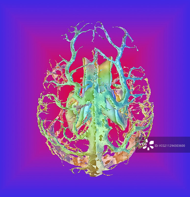 人脑脑室和静脉，3D核磁共振扫描图片素材