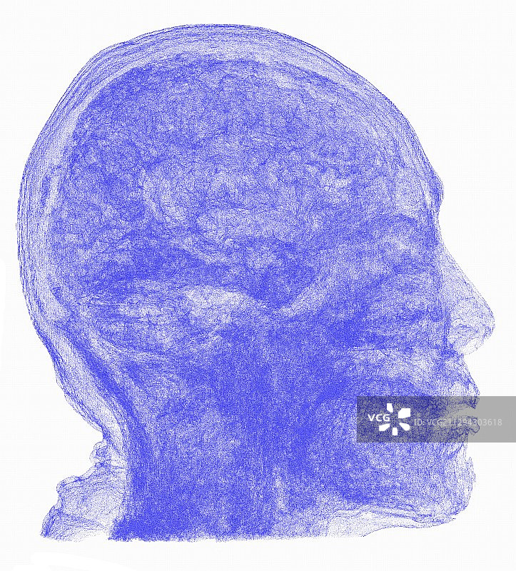 人头3D核磁共振扫描图片素材