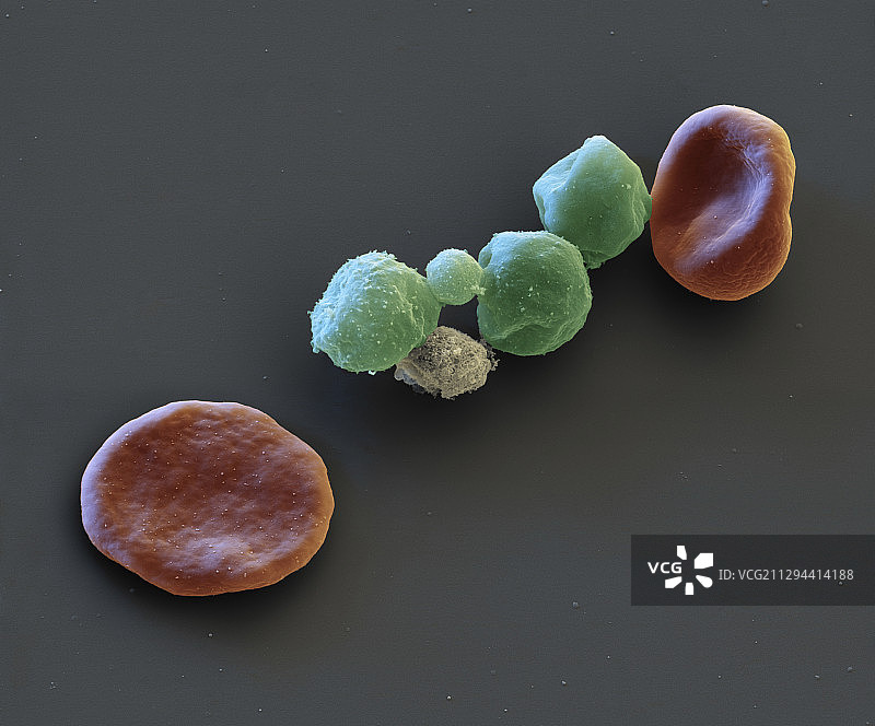 感染疟疾的红细胞，扫描电子显微镜图图片素材