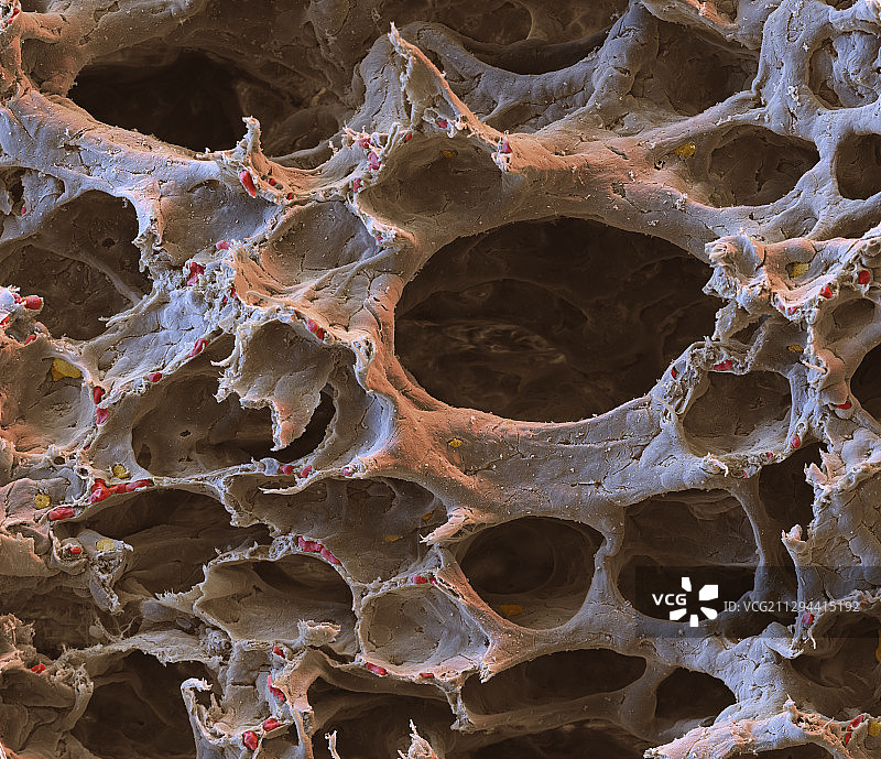 肺泡扫描电镜图图片素材