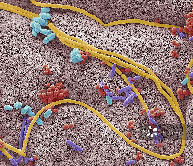 手机上的细菌，扫描电镜照片图片素材
