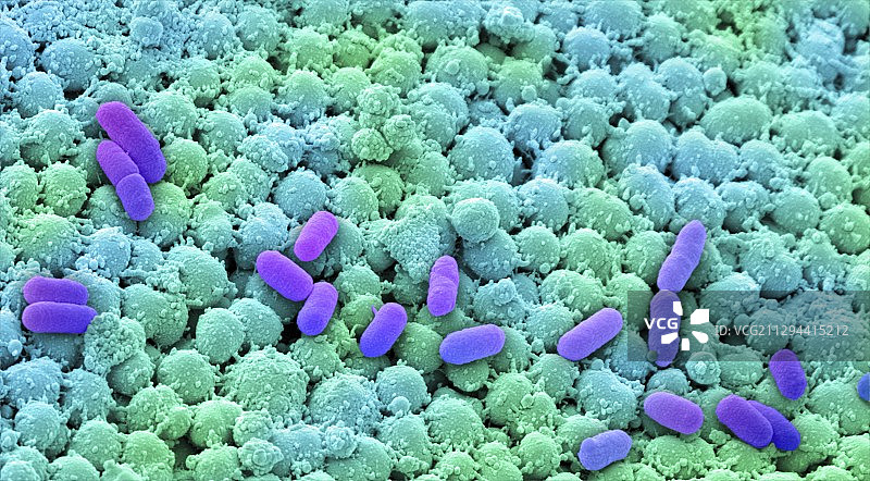 鼻腔细菌培养，扫描电镜图片素材