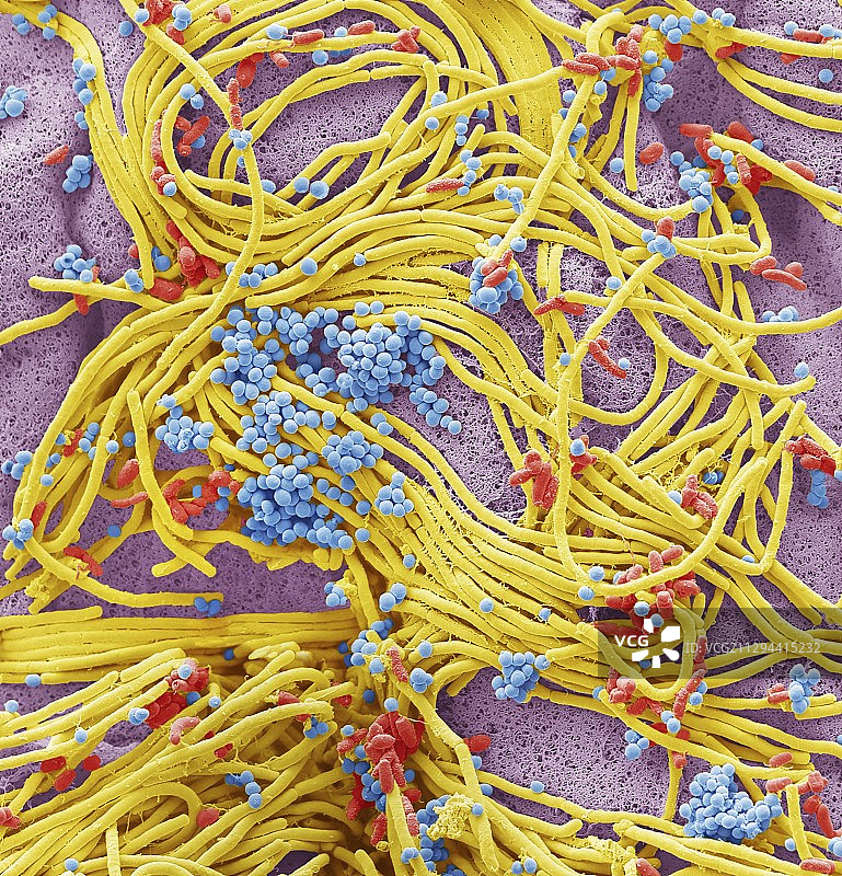 手机上的细菌，扫描电镜照片图片素材