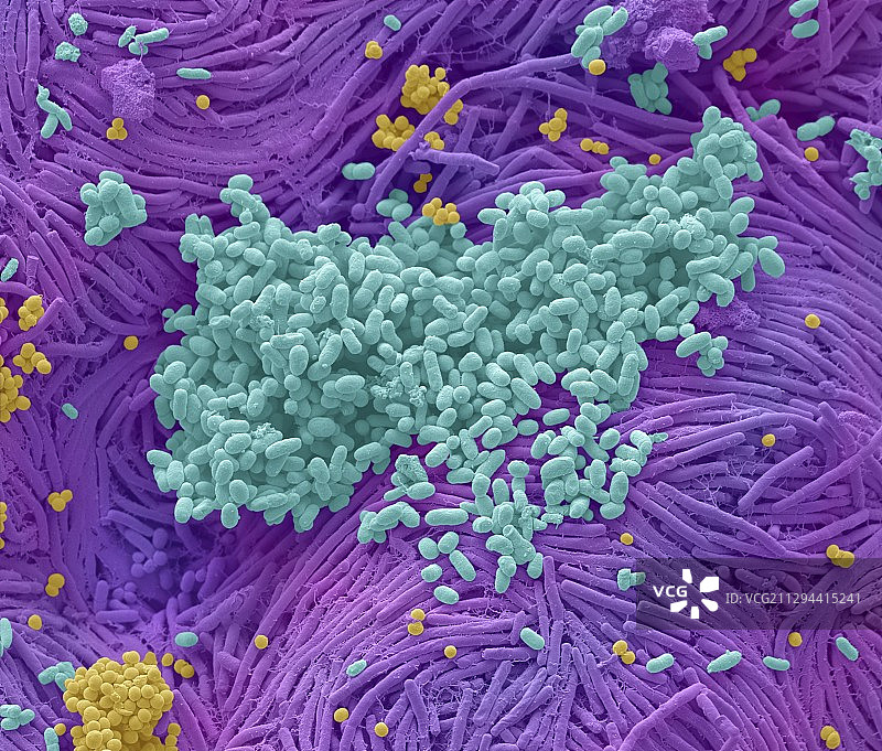 手机上的细菌，扫描电镜照片图片素材