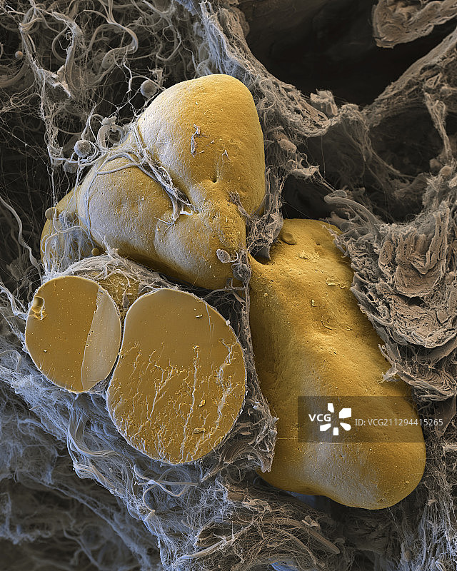 脂肪细胞，扫描电镜图片素材