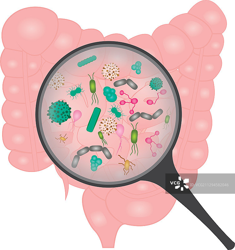 小肠细菌过度生长图片素材