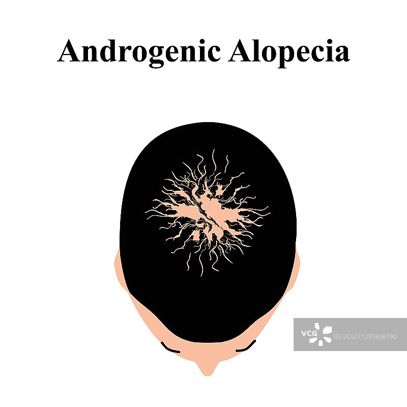 头部脱发图片素材