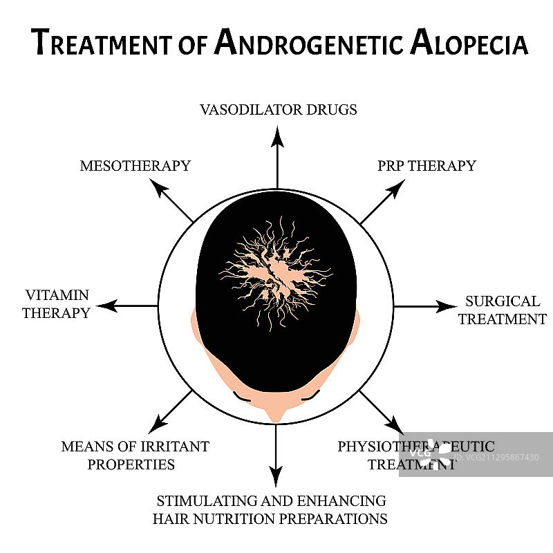 脱发秃斑治疗图片素材
