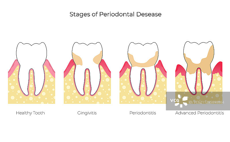 独立牙齿图片素材