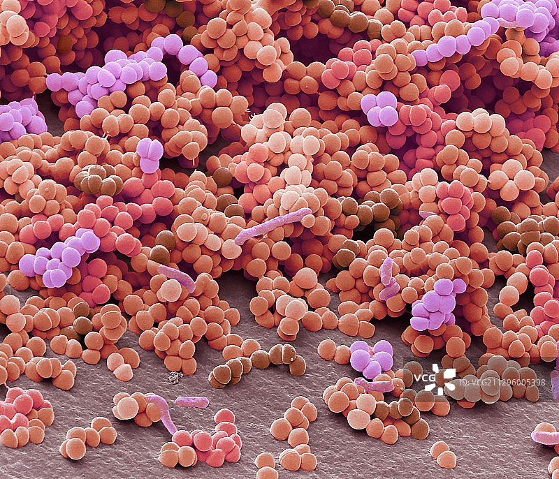 毛囊炎细菌（扫描电镜显微镜图像）图片素材