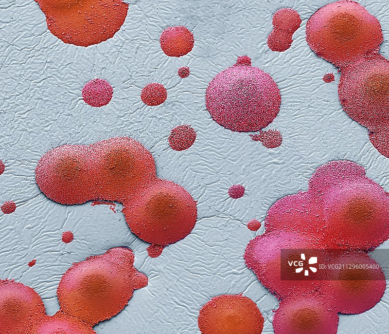 痰培养，扫描电子显微镜图片素材