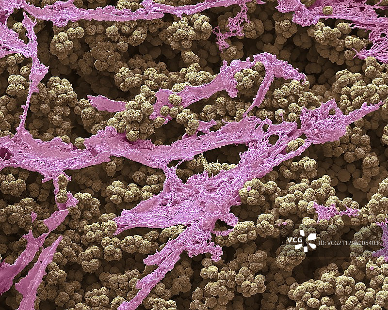 痰培养，扫描电子显微镜图片素材