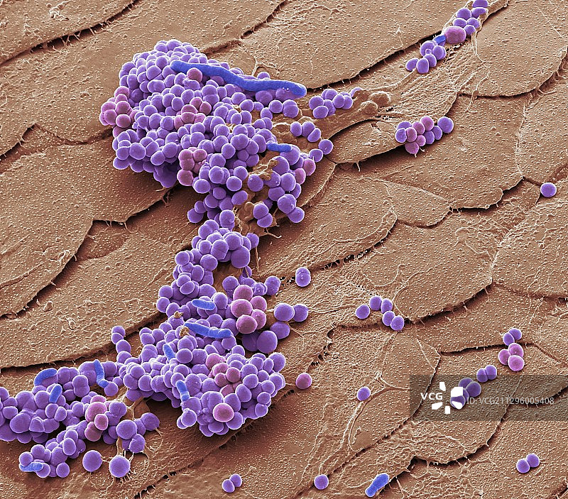 毛囊炎细菌（扫描电镜显微镜图像）图片素材