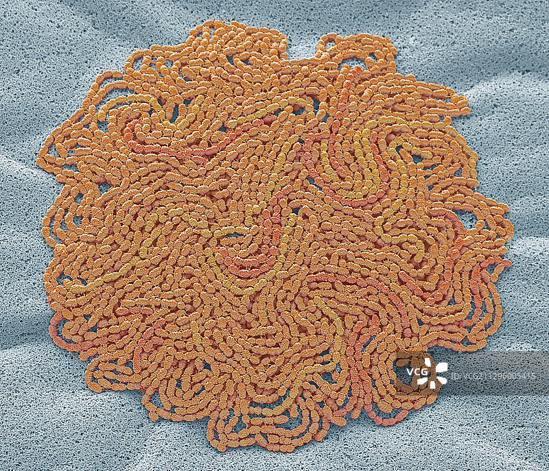 痰培养，扫描电子显微镜图片素材