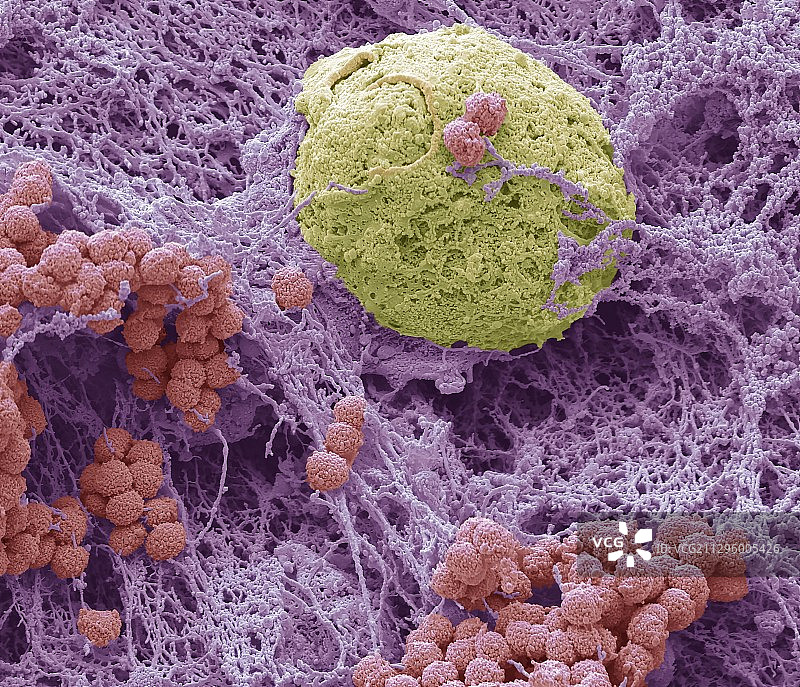 痰液扫描电镜图片素材