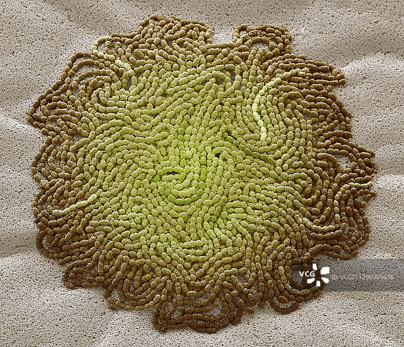 痰培养，扫描电子显微镜图片素材