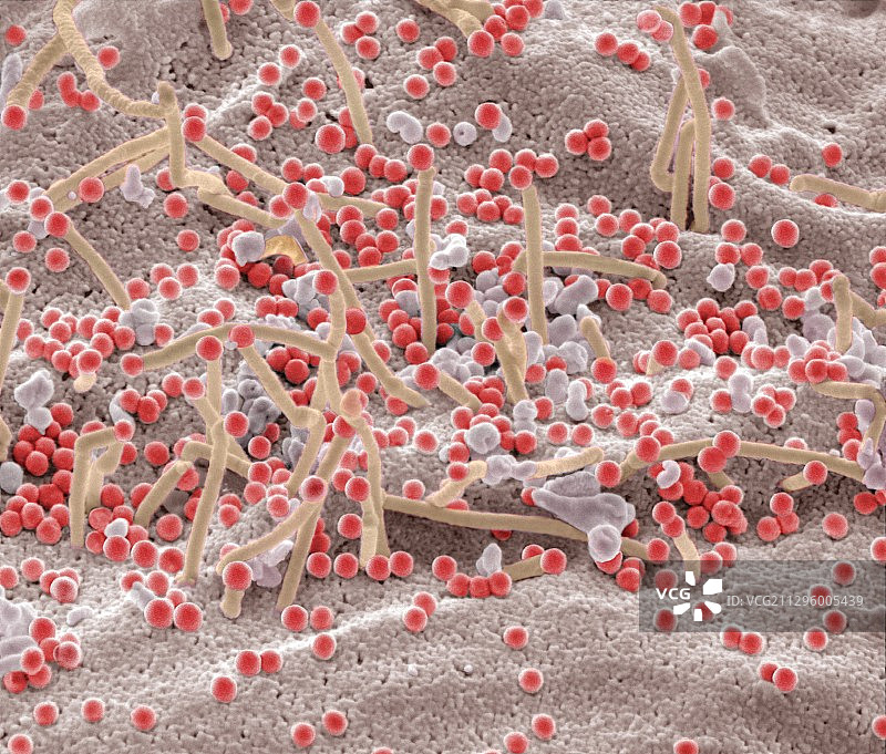 艾滋病毒感染细胞，扫描电镜图片素材