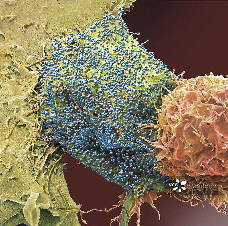 艾滋病毒感染细胞，扫描电镜图片素材
