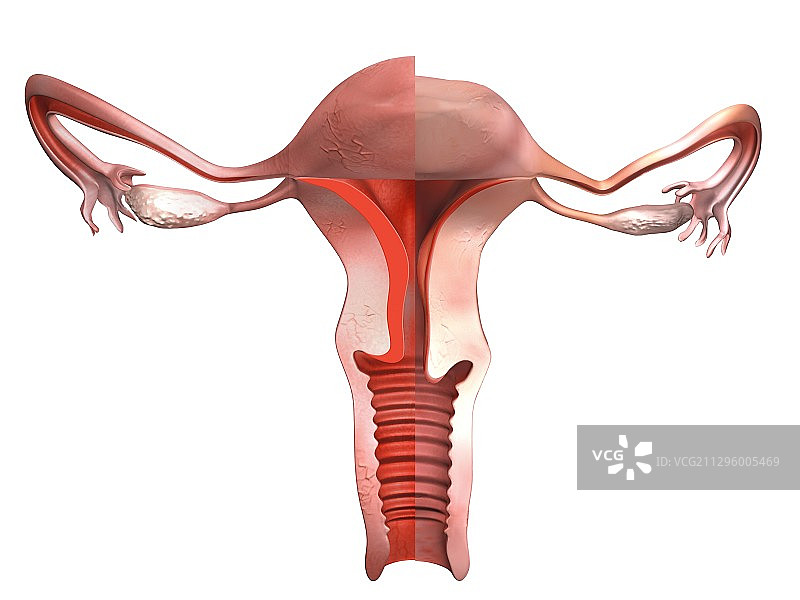 更年期阴道影响示意图图片素材