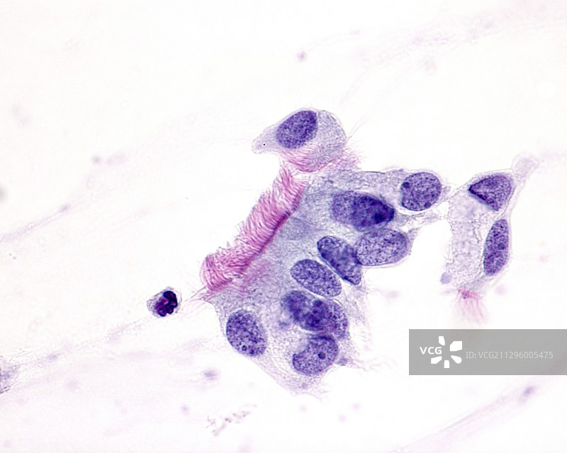纤毛上皮细胞显微照片图片素材