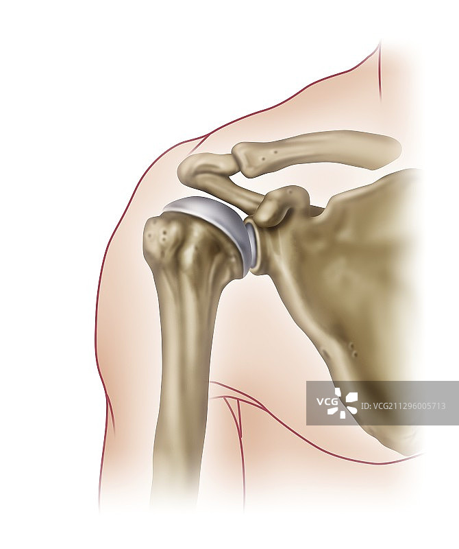 肩关节解剖结构插图图片素材