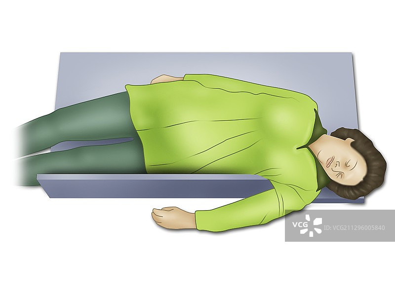 妊娠期加的夫楔形复苏，图示图片素材