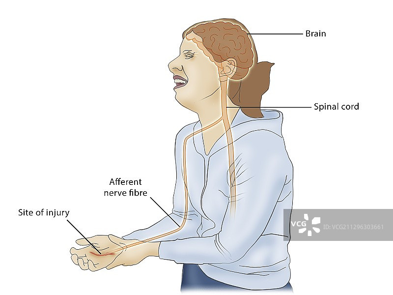 疼痛感知插图图片素材