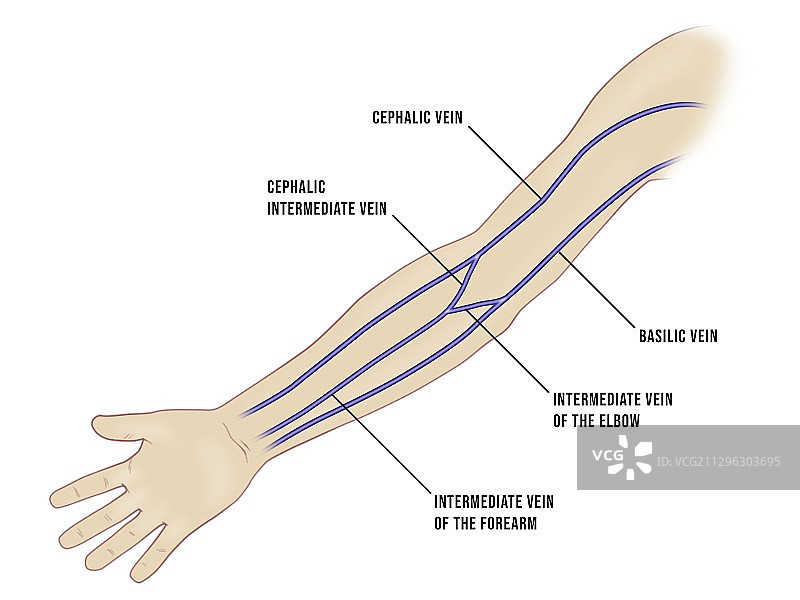 手臂静脉插管部位图图片素材