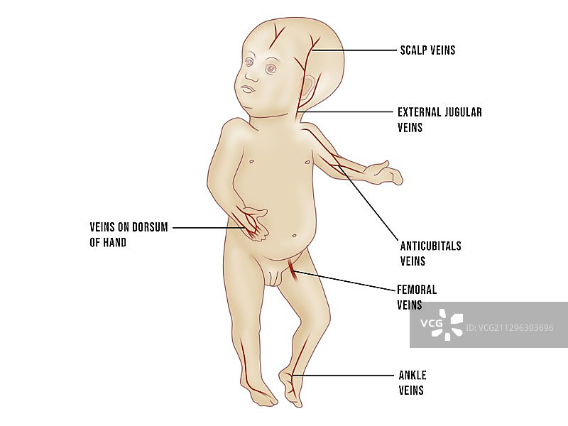 儿科静脉穿刺部位图示图片素材
