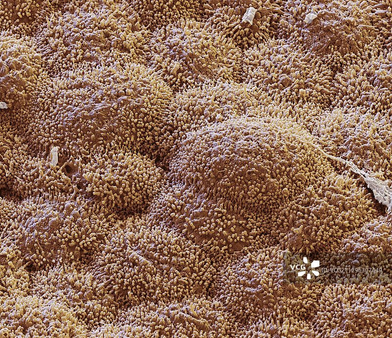 正常胃壁扫描电镜图图片素材