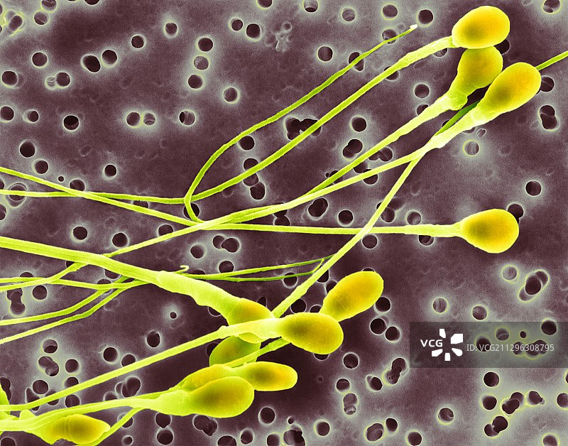 人类精子细胞，扫描电子显微镜图片素材