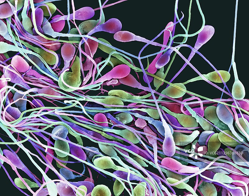 人类精子扫描电镜图图片素材