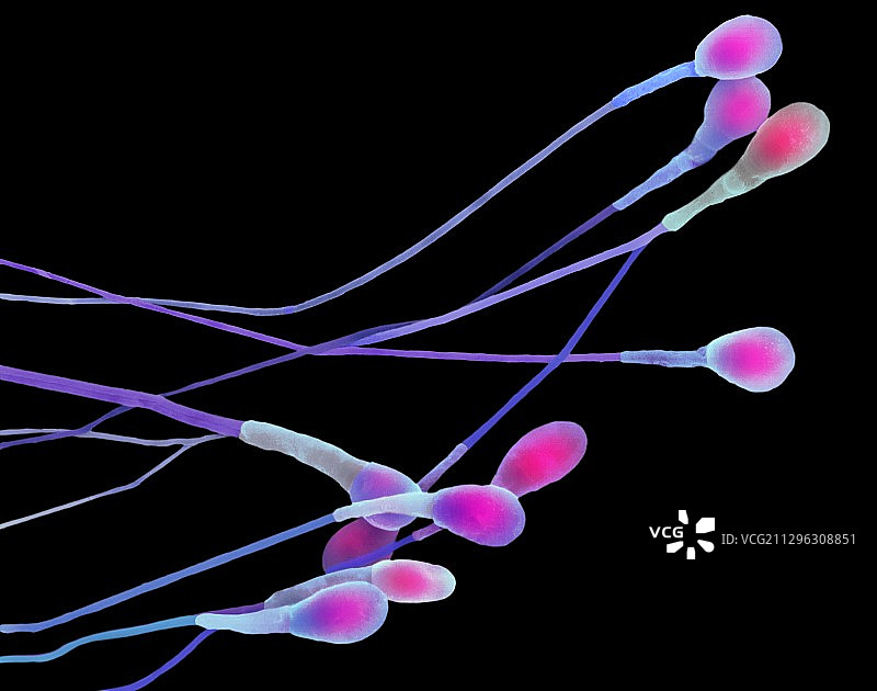 人类精子扫描电镜图图片素材