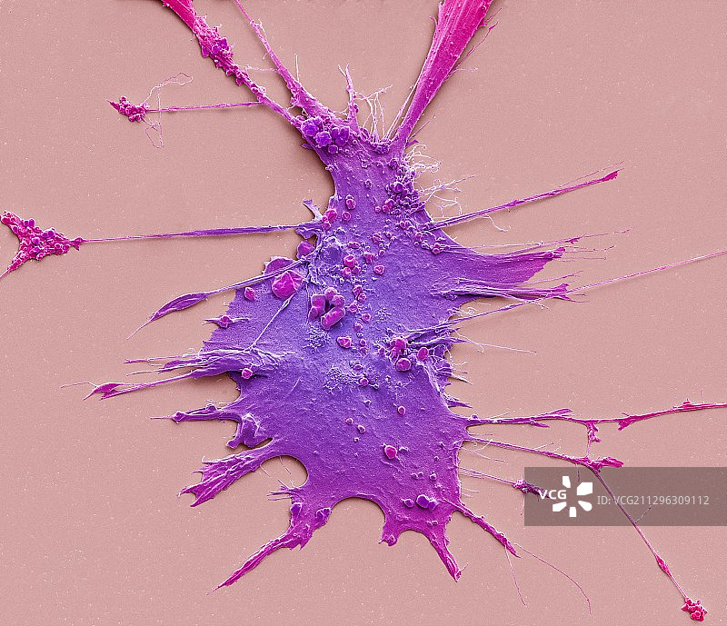 肝星状细胞扫描电镜图图片素材