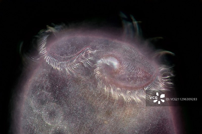 喇叭虫原生动物，光学显微照片图片素材