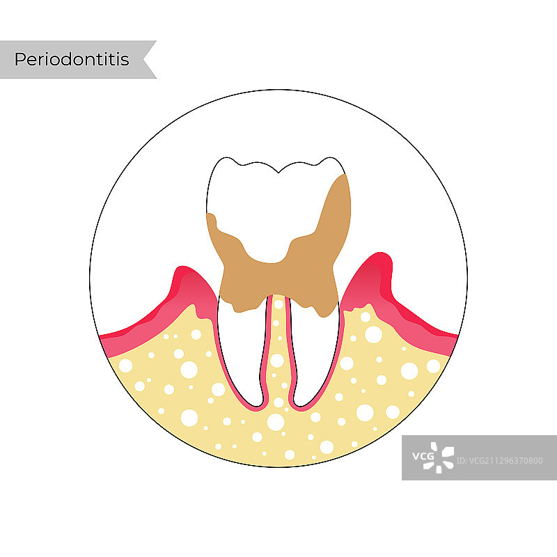 独立牙齿图片素材