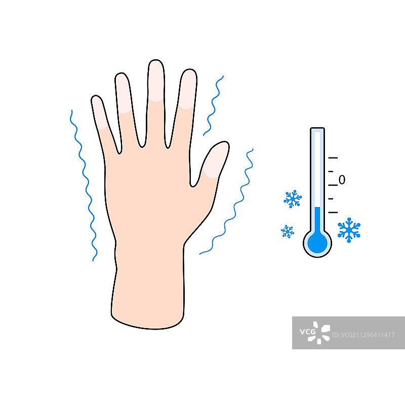 冻伤手部症状效果图片素材