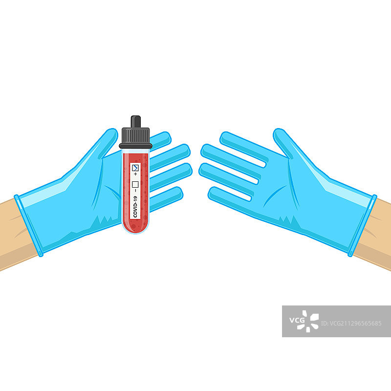 白色背景上的血液试管图片素材