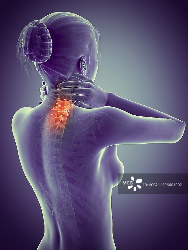 颈椎疼痛插画图片素材