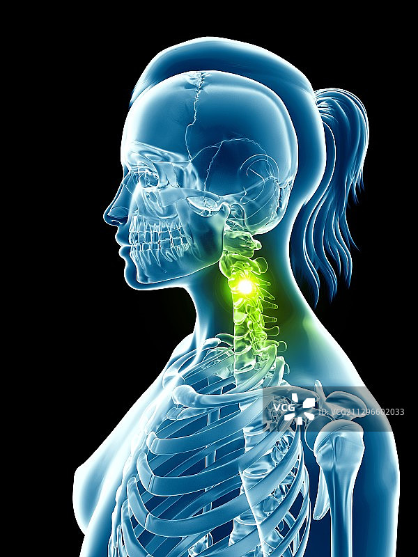 人类颈部骨骼插图图片素材