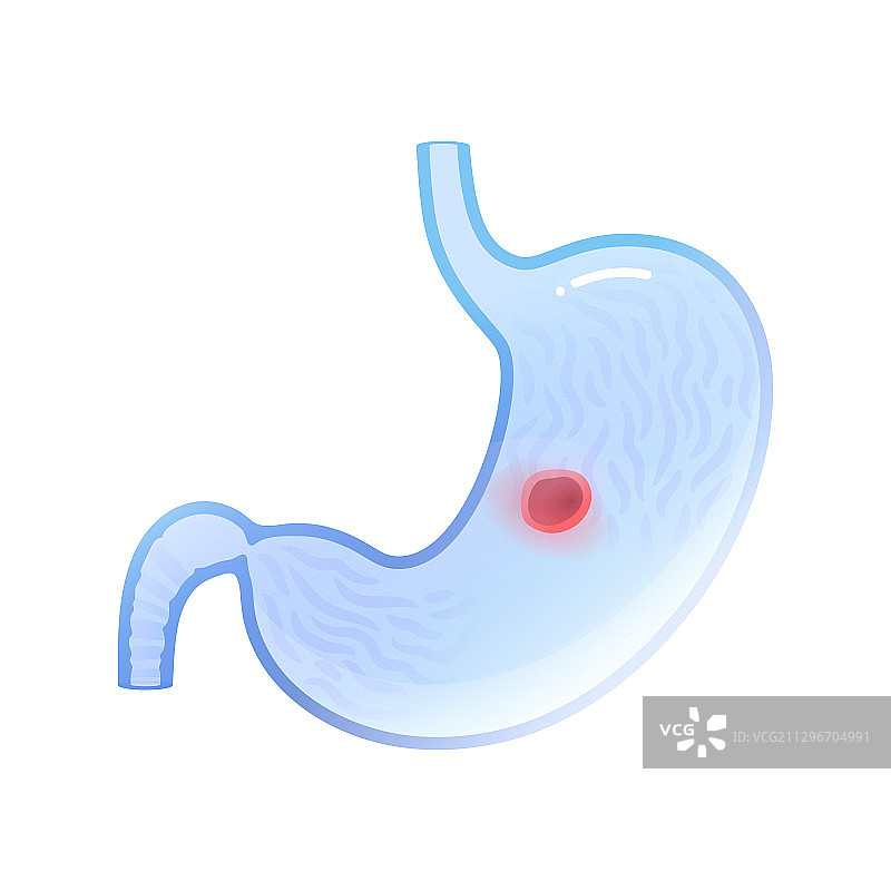 孤立的胃图片素材
